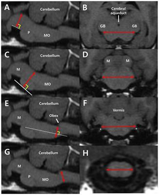 Measurement of brainstem diameter in small-breed dogs using magnetic resonance imaging